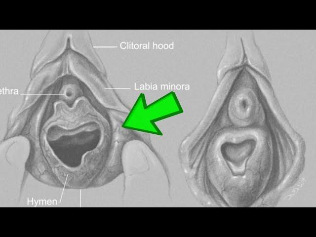 İlk cinsi əlaqədə - Qızlıq pərdəsi necə pozulur?