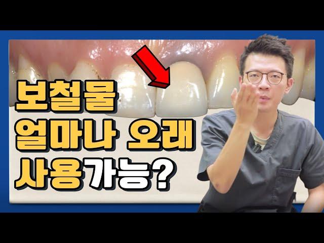 보철물의 수명이 따로 있나요?  평생사용 가능한가요?