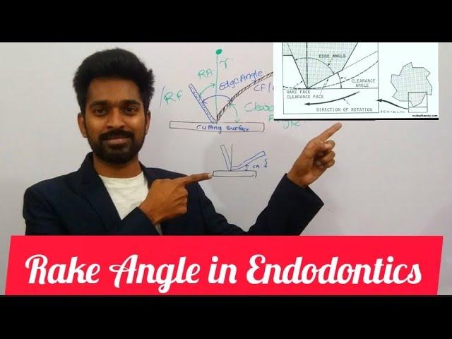 Rake Angle in Endodontics