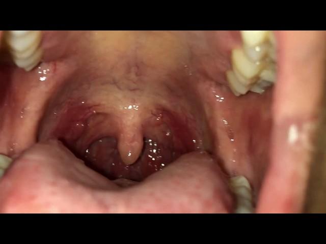 Inside my saliva covered mouth (male vore)