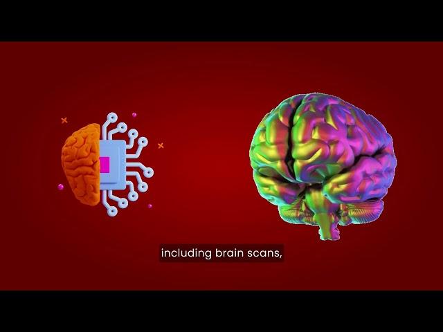 AI for differential diagnosis of dementia