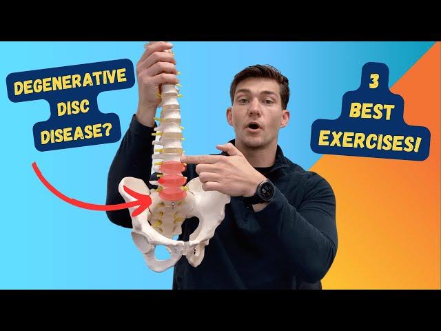 3 Best Exercises for Degenerative Disc Disease