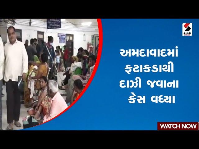 અમદાવાદમાં ફટાકડાથી દાઝી જવાના કેસ વધ્યા | Ahmedabad | Civil Hospital | Diwali | Gujarat