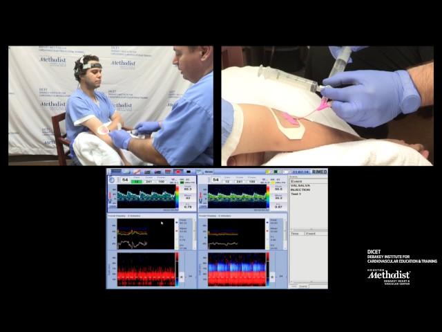 TCD BUBBLE TEST for Cardiac Shunt Detection PFO TEST (Zsolt Garami, MD)