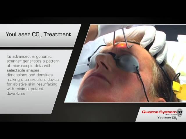 Quanta YouLaser CO2 | Fractional CO2 Laser