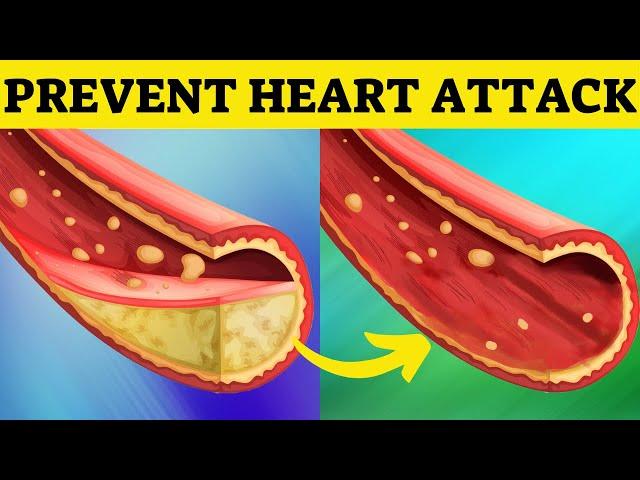 FEAR OF HEART ATTACK?! UNCLOG Arteries with These Superfoods!