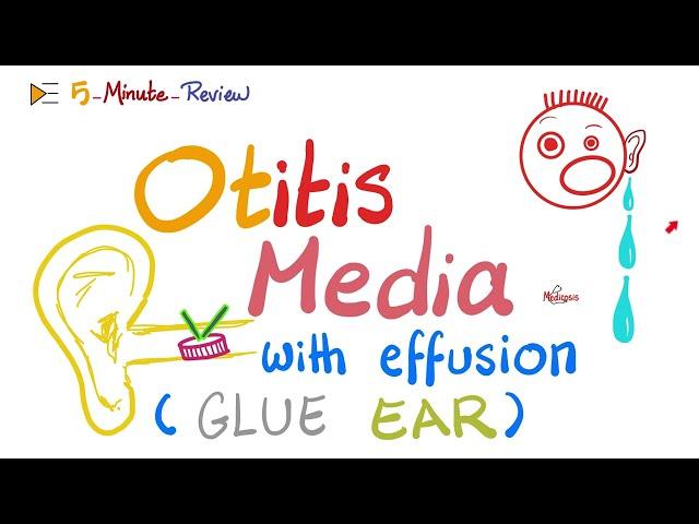 Otitis Media with effusions - Glue Ear