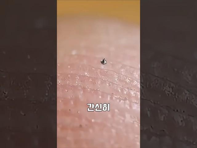 작은 부품, 큰 기술