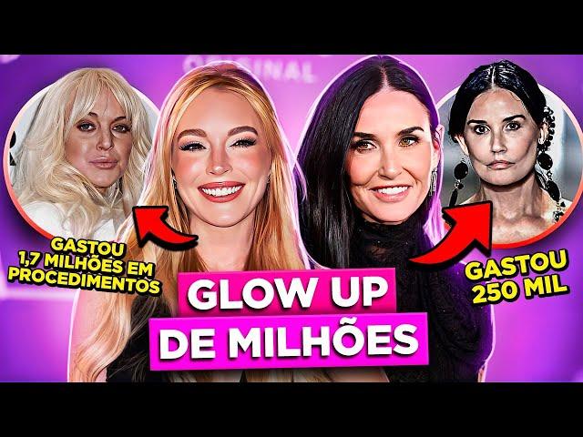 PROCEDIMENTOS ESTÉTICOS DAS FAMOSAS QUE CHOCARAM A INTERNET | Diva Depressão