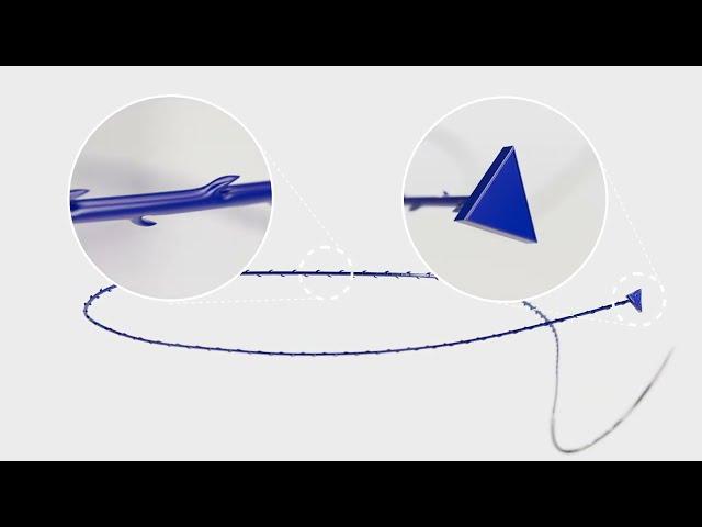 UNIFY Barbed PDO Surgical Sutures