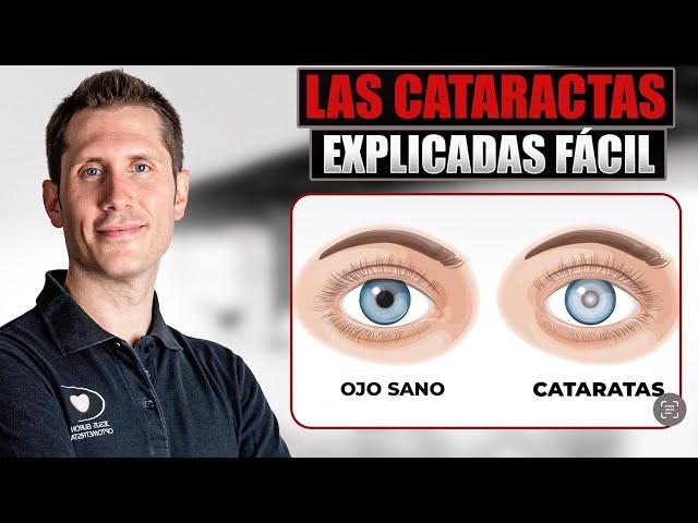  ¿Que son las CATARATAS de TUS OJOS?