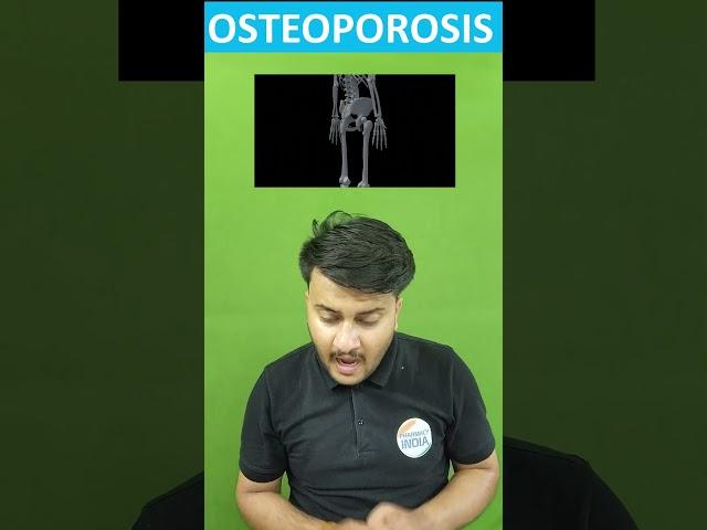 Osteoporosis Causing Drugs ‍#gpat2024 #pharmacology