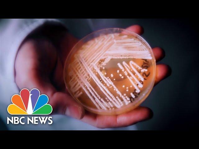 CDC warns dangerous fungus infection poses nationwide threat