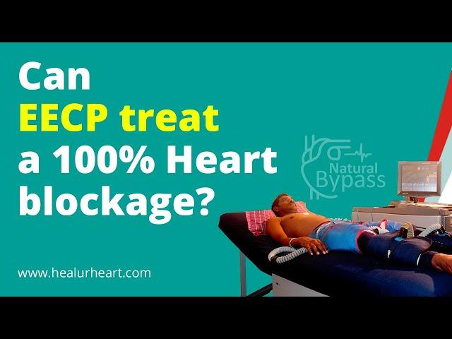 Can EECP treat a 100%  Heart blockage?