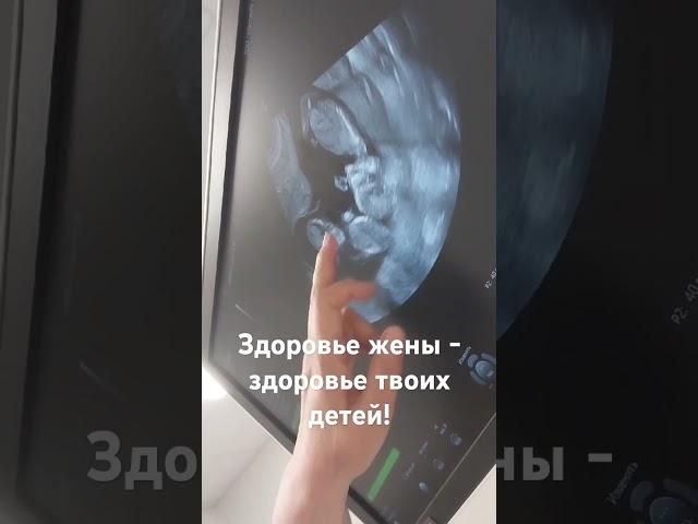 #беременность #перинатальныйцентр #гендерпати