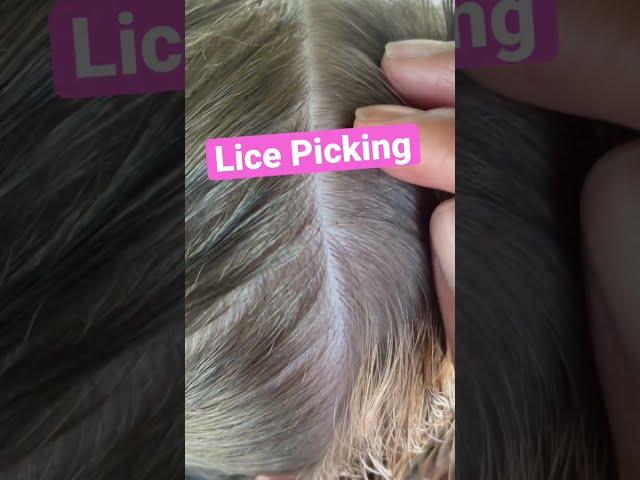 Lice Picking  l Pulling Small Louse Out of Hair  l Lice Removal Service @staceythelouselady