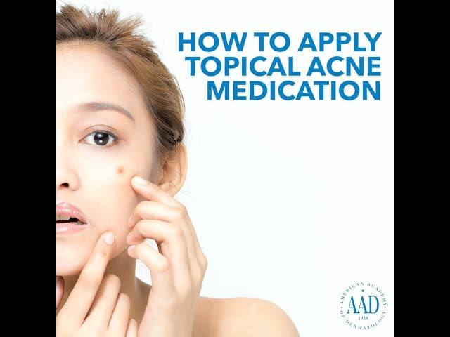 How to apply topical acne medication