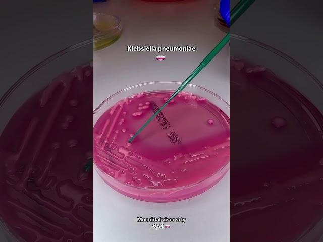 Klebsiella pneumoniae - Culture and Sensitivity test Medical Microbiology laboratory
