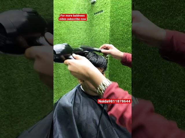 Hair Patch In Service In Noida | Hair Wig For Men | #short #hairpatch #viral #youtubeshorts #viral
