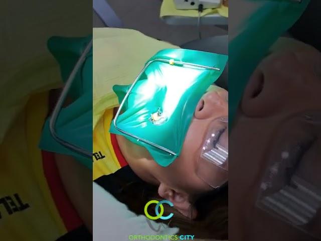 Tratamiento de Conducto/Endodoncia