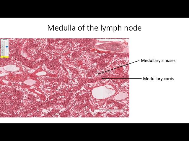 Histology with Chimmalgi: Lymph Node