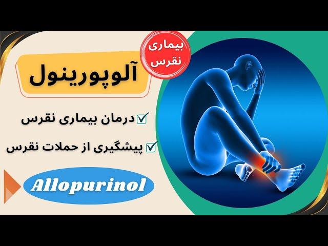 درمان بیماری نقرس و جلوگیری از حملات حاد نقرس با داروی آلوپورینول (Allopurinol)