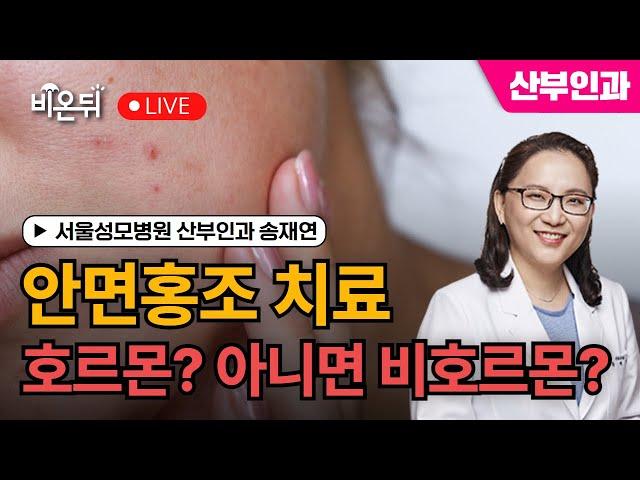 호르몬? 비호르몬? 안면홍조 치료, 당신에게 맞는 해답은? / 서울성모병원 산부인과 송재연