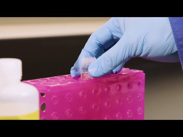 Quick Tips: How to Image a Chemiluminescent Western Blot