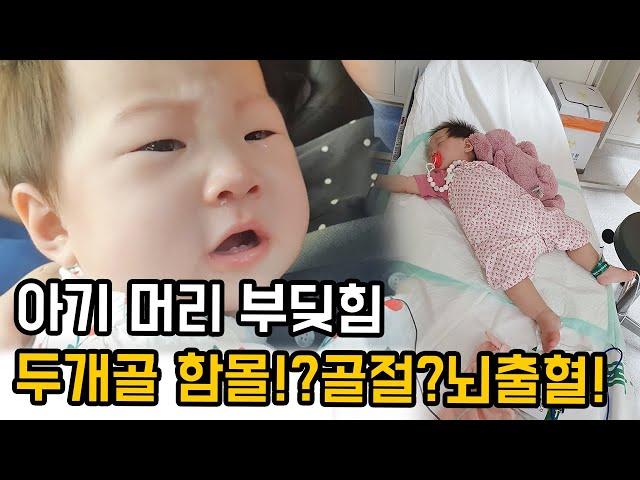 9개월 아기머리 다쳤을때 응급실 | 두개골골절 | 두개골함몰 | 뇌출혈 |  고대안산병원, 이대목동병원, 서울대어린이병원 소아신경외과 병원일기