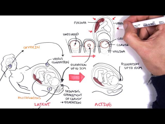 Obstetrics - Stages of Labour