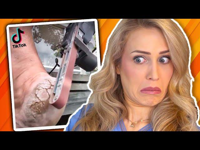 Doctor reacts to INSANE pedicure TikToks (part 2)