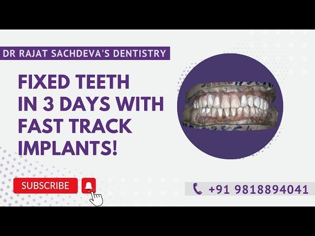 Full Mouth Dental Implants India | Fixed Teeth in 3 Days |  Dental Implants Cost in India