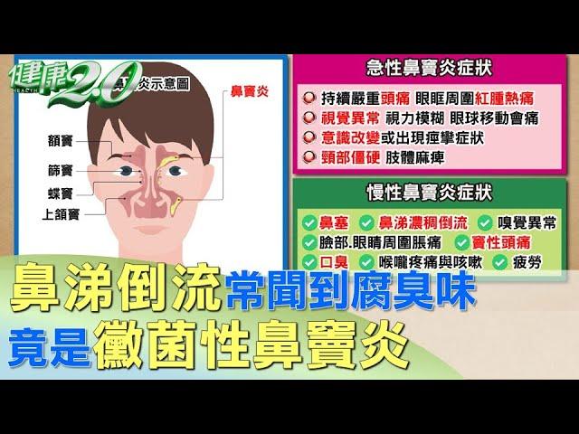 男子鼻涕倒流.常聞到腐臭味 竟是黴菌性鼻竇炎 健康2.0