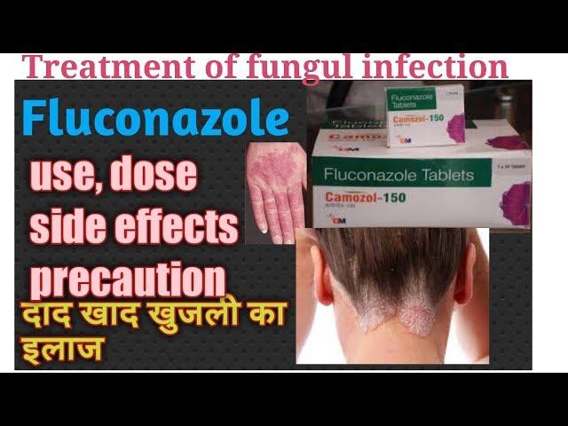 Fluconazole Tablets 150 mg, 200mg uses in hindi || Fluconazole dose side effects