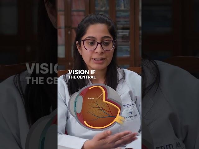 Protect Your Vision with Early Detection | Retinal detachment - Dr. Stuti @shroffeyecentre.official