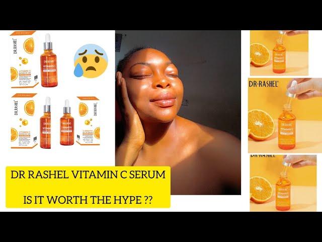 DR RASHEL VITAMIN C SERUM ,WHAT YOU SHOULD KNOW BEFORE BUYING IT.HONEST REVIEW