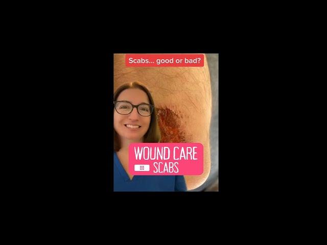 Scabs: Wound Care | @LevelUpRN