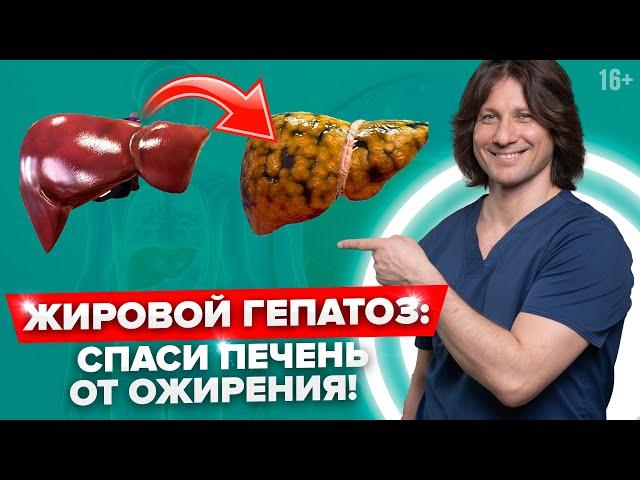 Опасность ЖИРНОЙ ПЕЧЕНИ! Как лечить ЖИРОВОЙ ГЕПАТОЗ? Симптомы, диагностика и ДИЕТА для печени