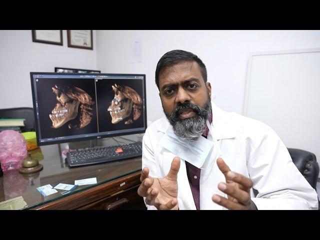 Bimaxillary Osteotomy Surgery - Double Jaw Surgery Case Study