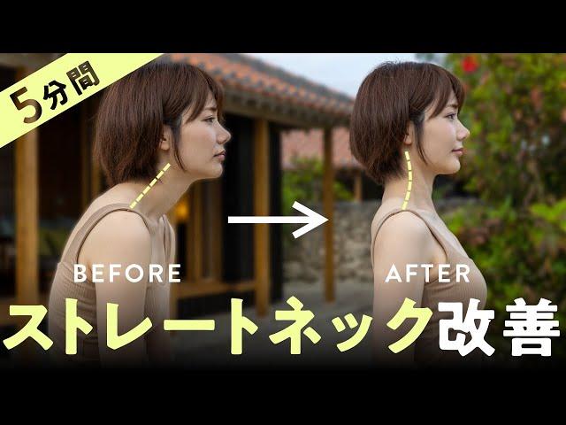 顔のたるみと猫背の原因！ストレートネックを自力で改善するストレッチ