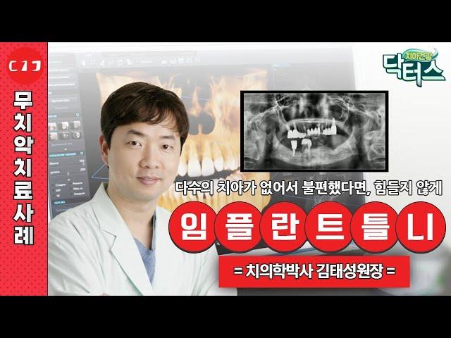 다수의 치아가 없어서 불편했다면 더 힘들지 않게!