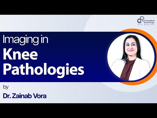 Imaging in Knee Pathologies by  Dr. Zainab Vora  | Conceptual Radiology | Radiology Residency