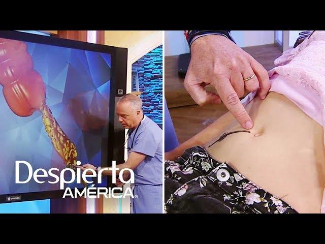 Apendicitis: causas, síntomas y cómo detectarla fácilmente | Dr. Juan