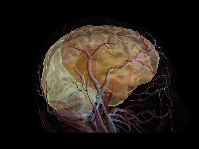 Stroke vs. Aneurysm: Different Symptoms, Treatments