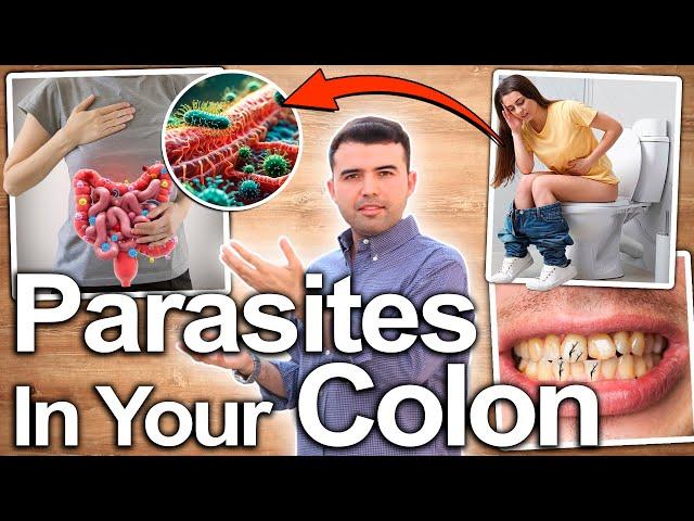 YOU ARE FULL OF PARASITES - Symptoms That Indicate That You Need A Parasite Cleanse