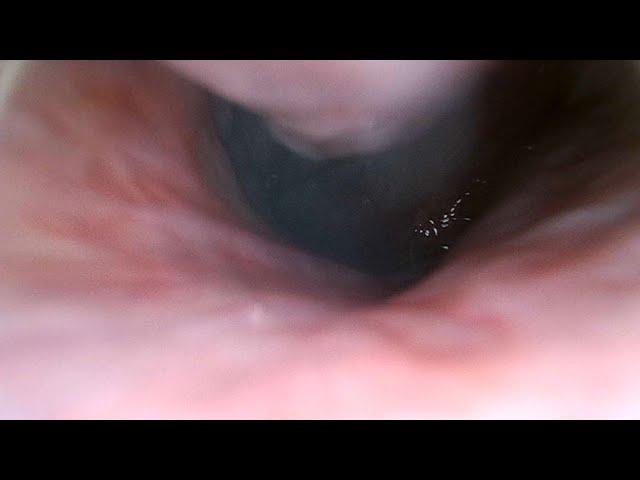 What it Looks like Inside a Human Nose