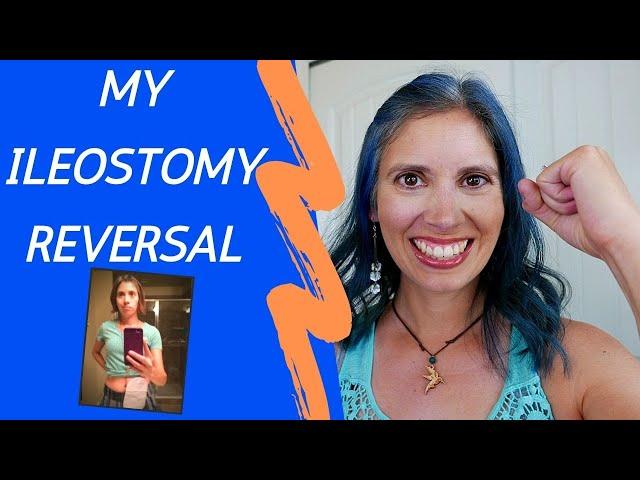 My Ileostomy Reversal Experience