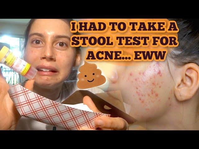 I HAD TO TAKE A STOOL TEST FOR MY ACNE and GUT HEALTH!?!?  MY REACTION, THE PROCESS AND EXPERIENCE..