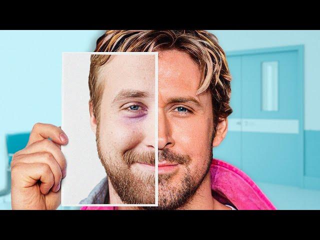 Is Ryan Gosling's Face All Natural? | Plastic Surgery Analysis