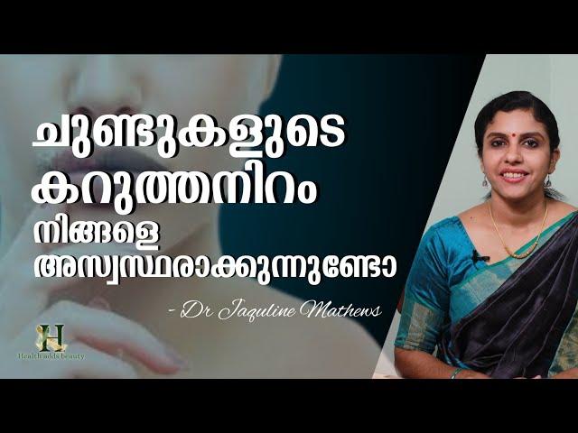 Lip pigmentation | ചുണ്ടുകളുടെ കറുത്ത നിറം | Natural remedies | Dr Jaquline Mathews BAMS